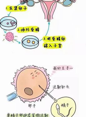 2026年东营试管婴儿三代费用明细清单