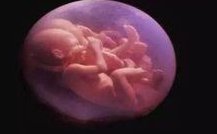 2026年RFC医院试管婴儿费用明细一览表